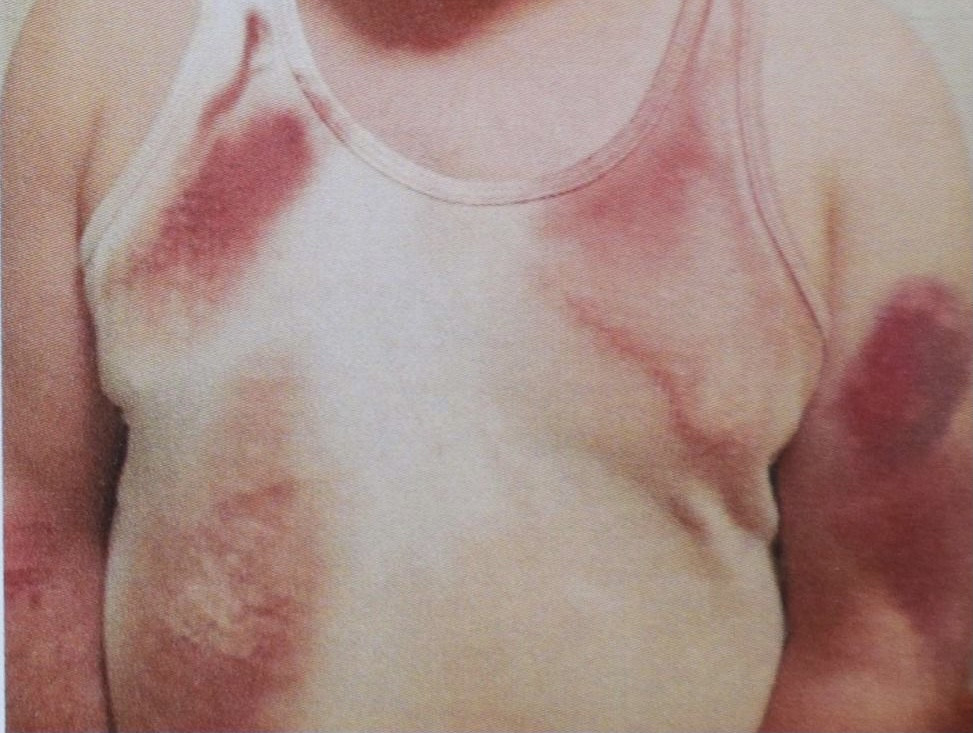 Побиття затриманого металевим ломом – підозрюють двох столичних поліцейських (ФОТО)